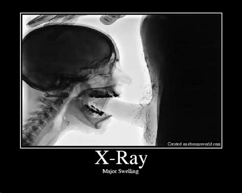 If experienced feminist researchers and activists are deeply negatively affected just by watching these images, what effect. . Deepthroat xray